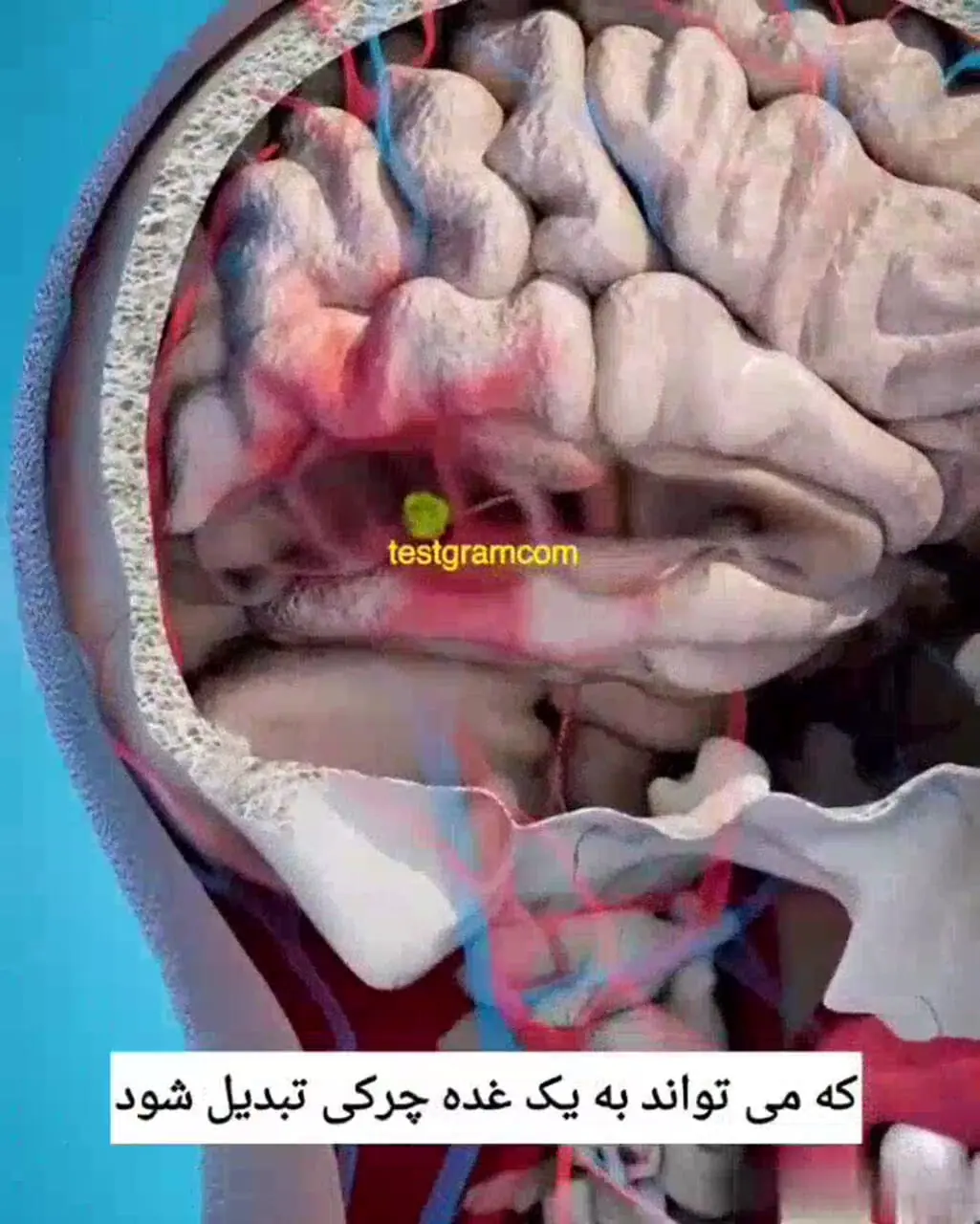  دندان عفونی چه بلایی سرتان می‌آورد؟ + فیلم