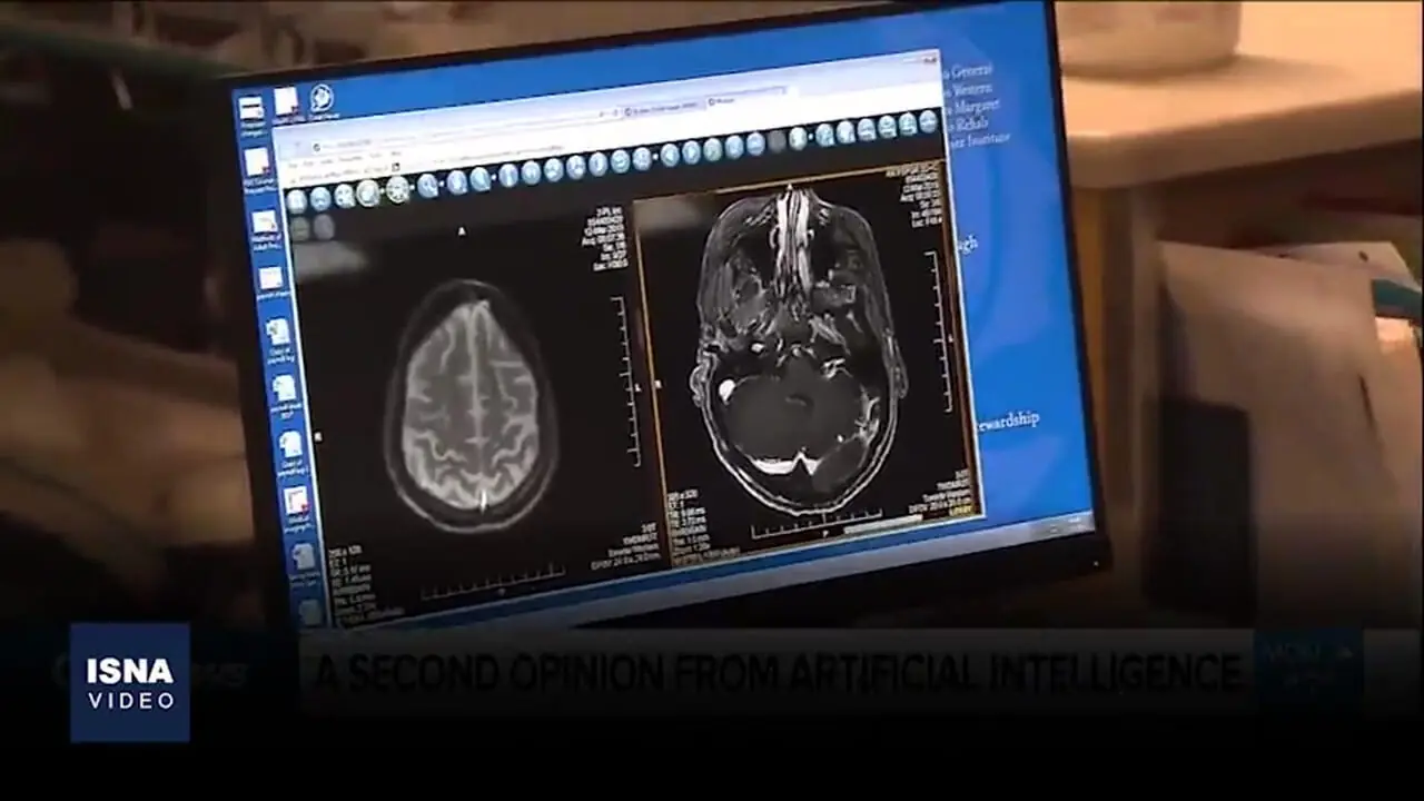 جراحی مغز هم با هوش مصنوعی ممکن شد+ فیلم