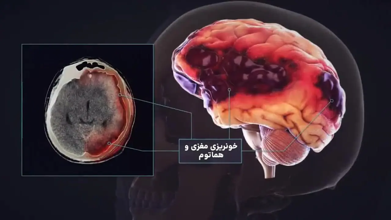 کمربند ایمنی؛ مرز بین زندگی و مرگ + فیلم