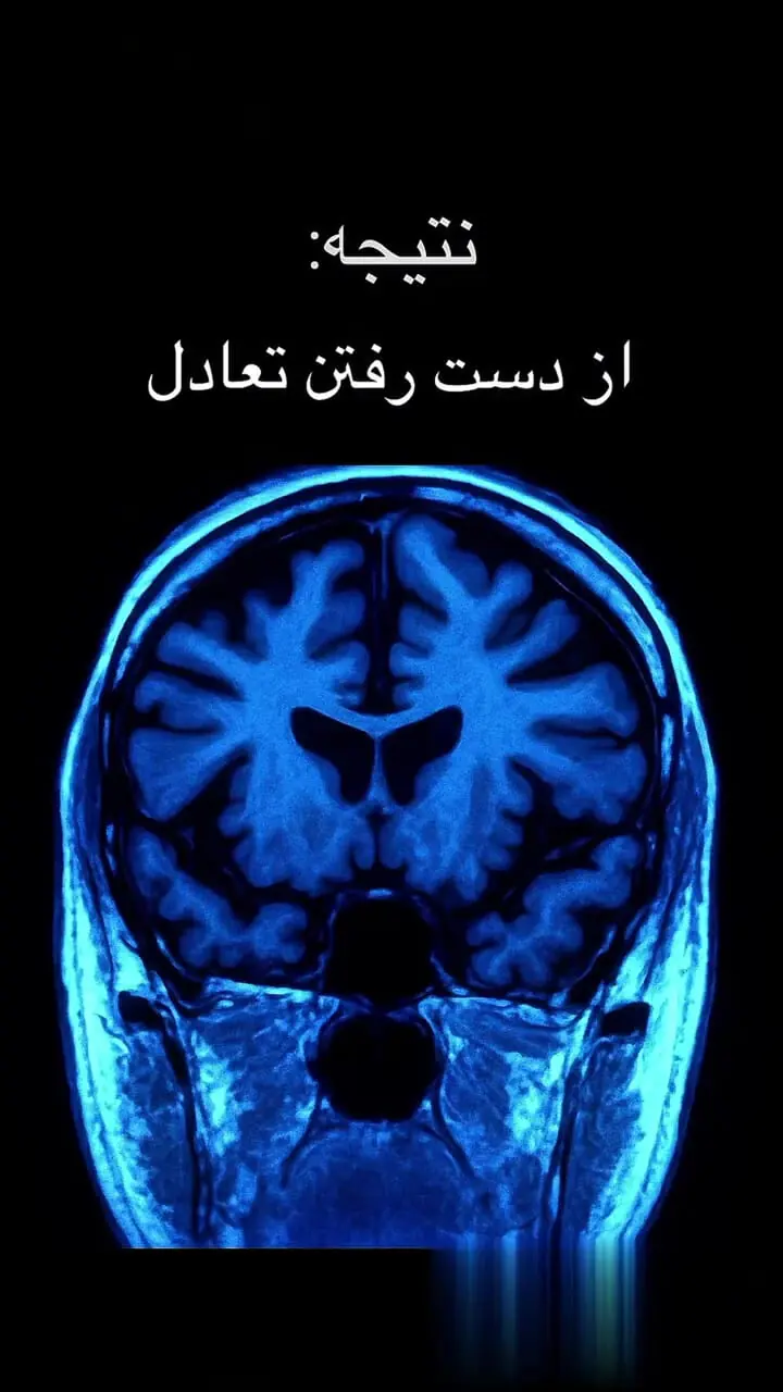 تصاویری غم انگیز از تحلیل رفتن مغز + فیلم